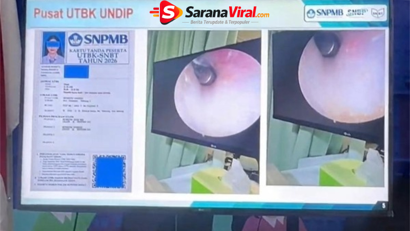 alat curang utbk di telinga